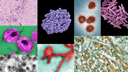 بیماری های غیرواگیر، قاتل جهانی هستند