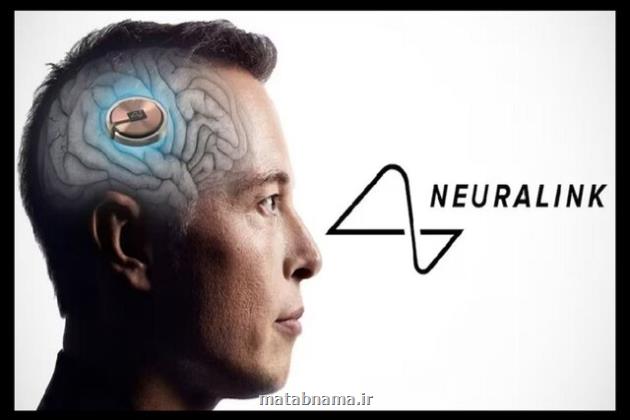 از تراشه مغزی نورالینک بترسیم یا شگفت زده شویم؟