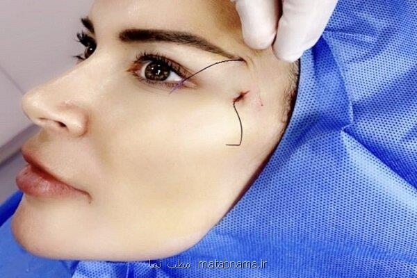 زیبایی روی بند نخ!