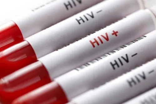 آغاز پویش من هم تست HIV می دهم از امروز تا ۲۰ آذرماه