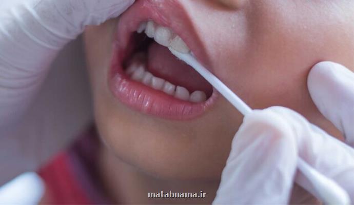 شیوع بالای انگل های دهانی در بیماران دیابتی