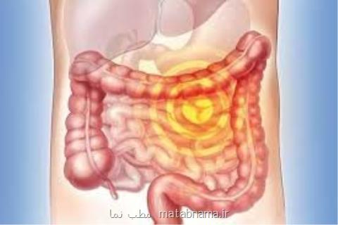 تاثیر بیان نسبی ژن ها در پیشرفت بدخیمی سرطان روده بزرگ