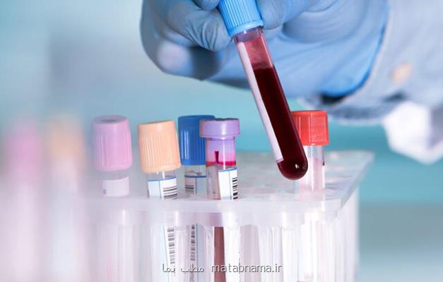 تحقیق برای سنجش زودهنگام سرطان از روی ادرار و خون