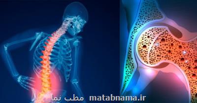 استقرار نظام پیش گیری از شكستگی های ثانویه ناشی از پوكی استخوان در كشور همسو با دنیا